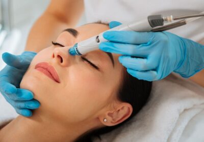 Hydrafacial for Acne: Can it Really Help Clear Your Skin?