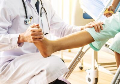 5 Pro Tips for a Quick Total Ankle Replacement Recovery