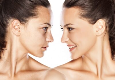 Reasons Why You Should Consider Facial Fat Grafting